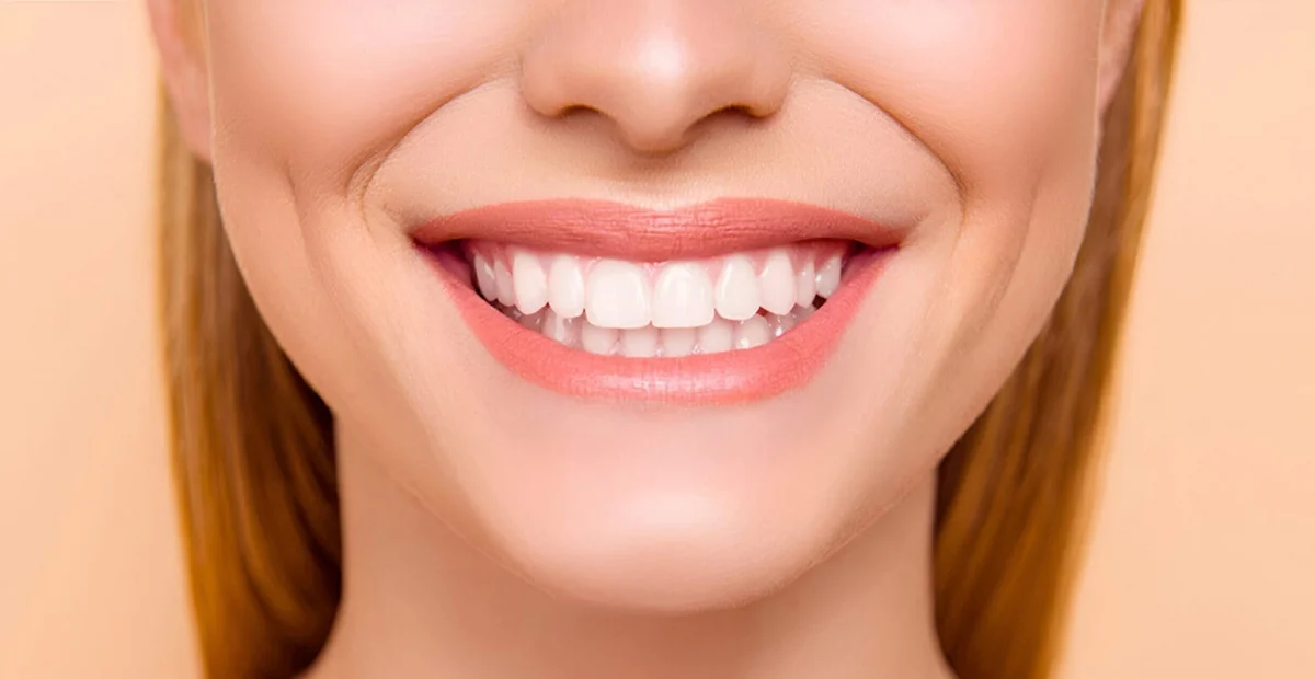 Teeth Whitening