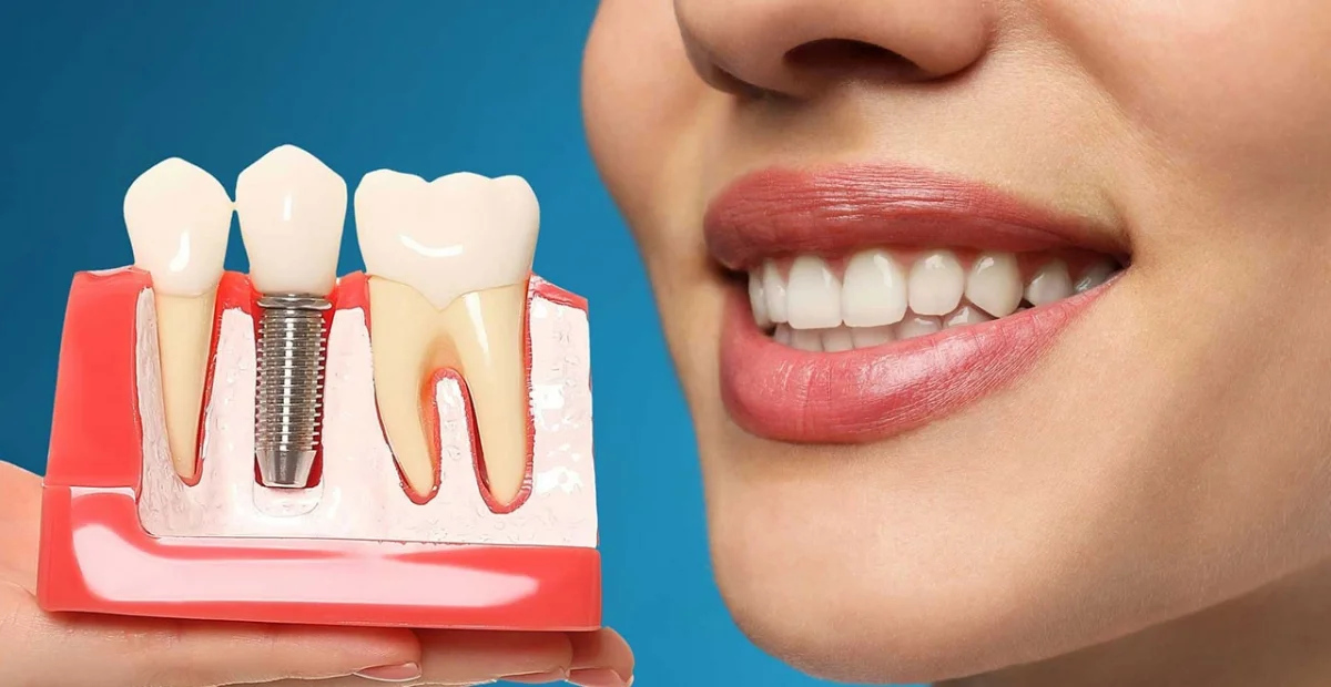 Implant Treatment