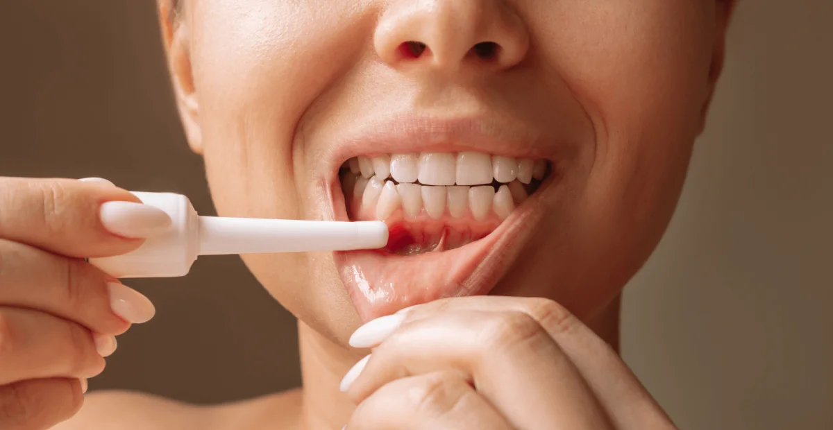 Periodontoloji (Diş Eti Hastalıkları)